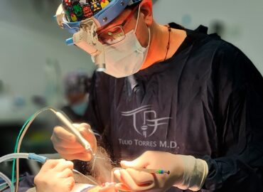 Doctor Tulio Torres Rinoplastia Ultrasonica